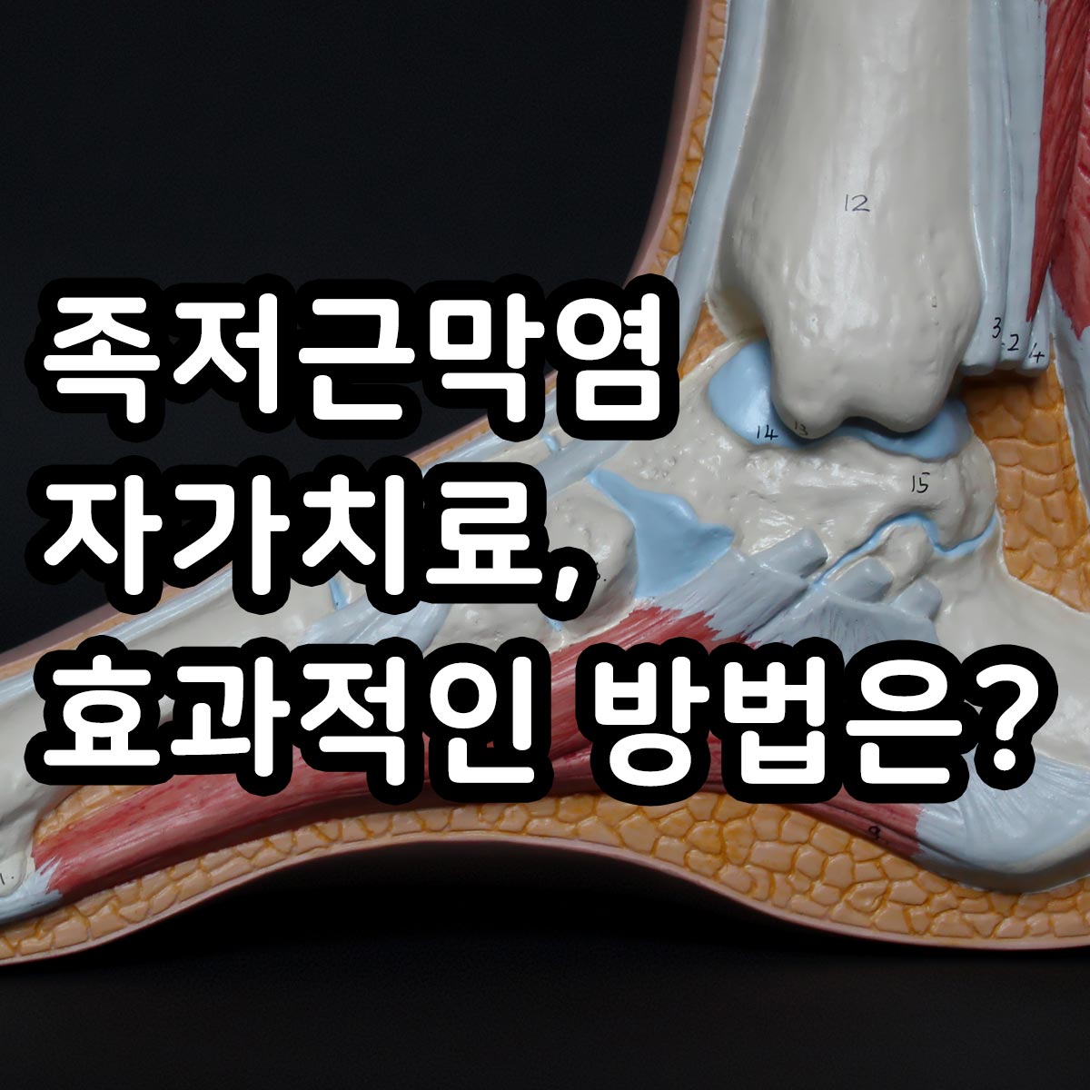 족저근막염 자가치료 방법