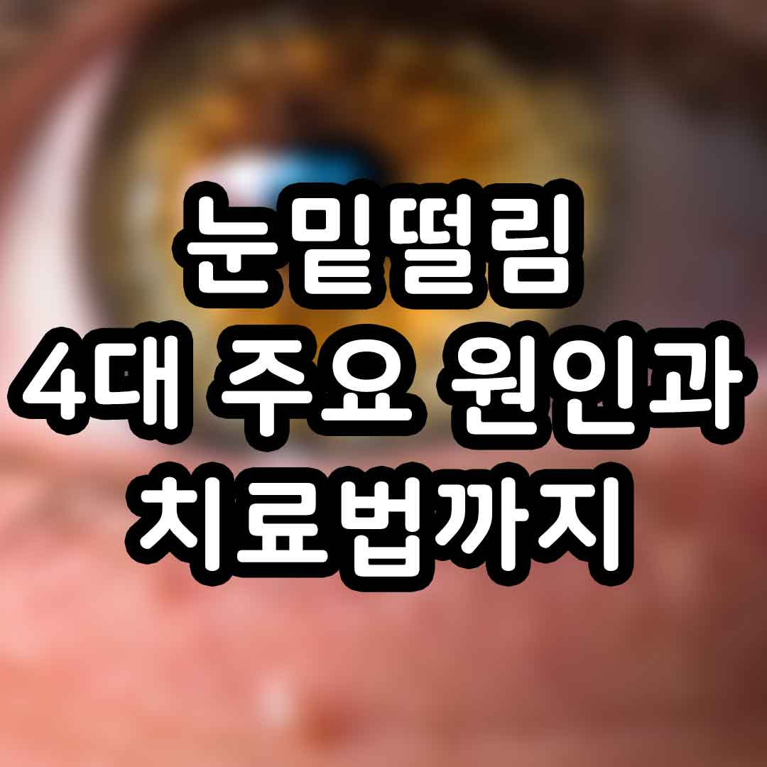 눈밑떨림 4대 주요 원인과 치료법까지