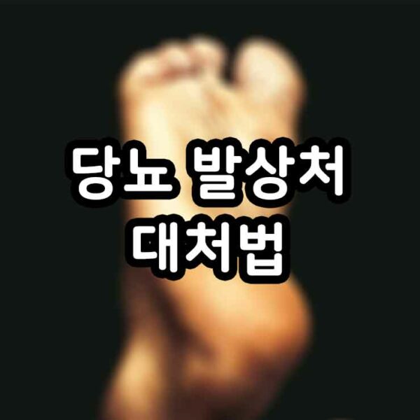 당뇨 발상처에 효과적인 대처법